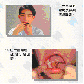 如何正確使用牙線10