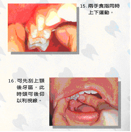 如何正確使用牙線11
