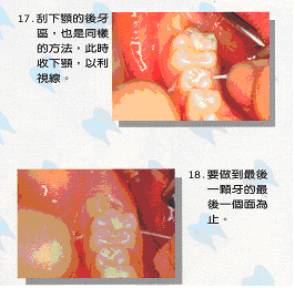 如何正確使用牙線12