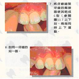 如何正確使用牙線7