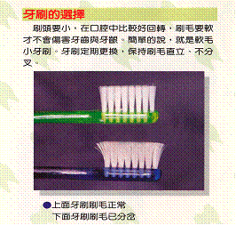 貝氏刷牙法1