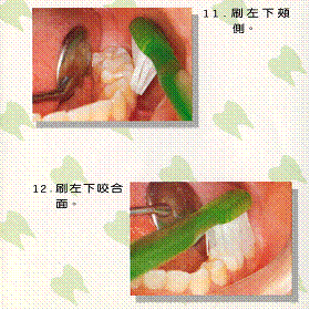 貝氏刷牙法10