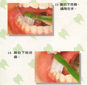 貝氏刷牙法12