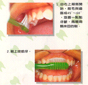 貝氏刷牙法5