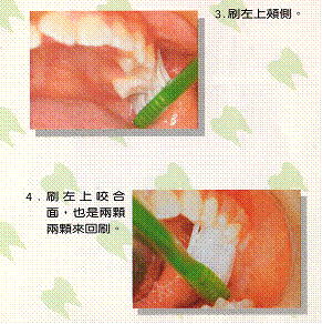 貝氏刷牙法6